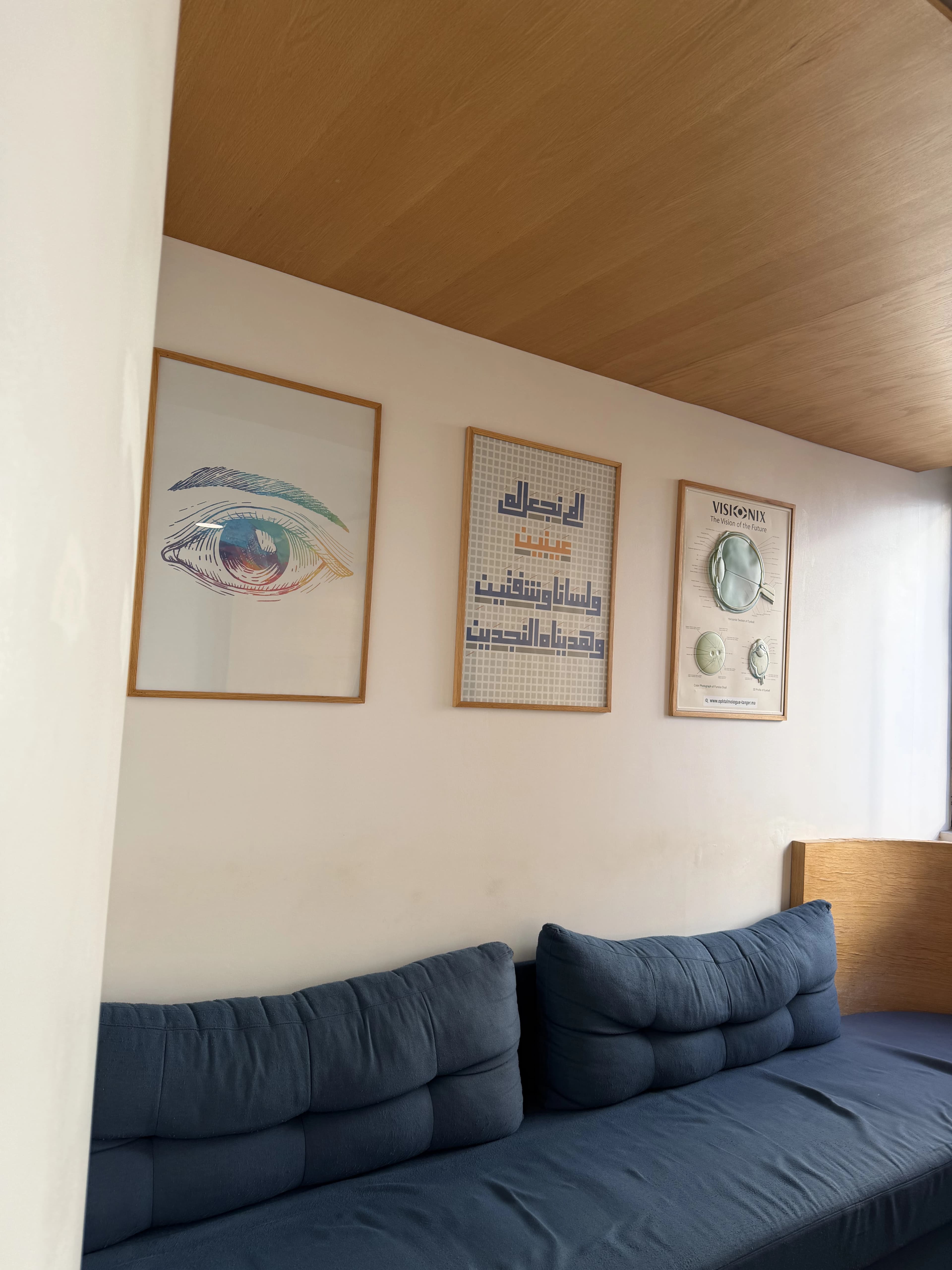 Affiches Anatomie de l'Œil